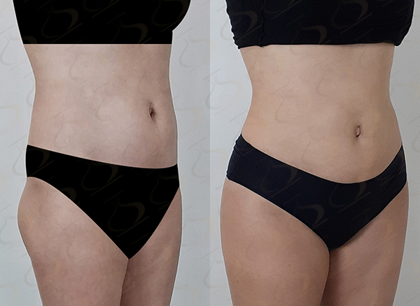 2dc1913b91c5f7e70ca3697767f2b6c1_1775437903_3671.jpg 2dc1913b91c5f7e70ca3697767f2b6c1_1775437903_3671.jpg