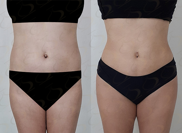 2dc1913b91c5f7e70ca3697767f2b6c1_1775437904_2225.jpg 2dc1913b91c5f7e70ca3697767f2b6c1_1775437904_2225.jpg