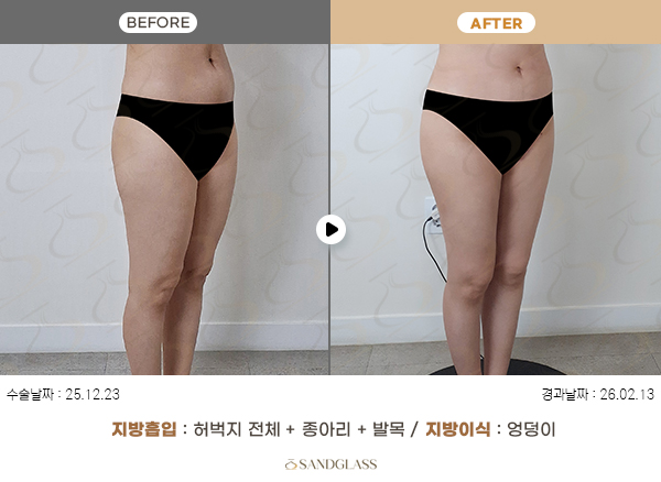 2dc1913b91c5f7e70ca3697767f2b6c1_1775437958_8658.jpg 2dc1913b91c5f7e70ca3697767f2b6c1_1775437958_8658.jpg