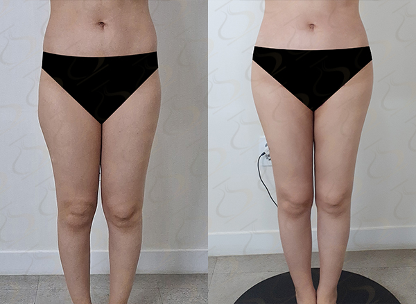 2dc1913b91c5f7e70ca3697767f2b6c1_1775437959_2655.jpg 2dc1913b91c5f7e70ca3697767f2b6c1_1775437959_2655.jpg