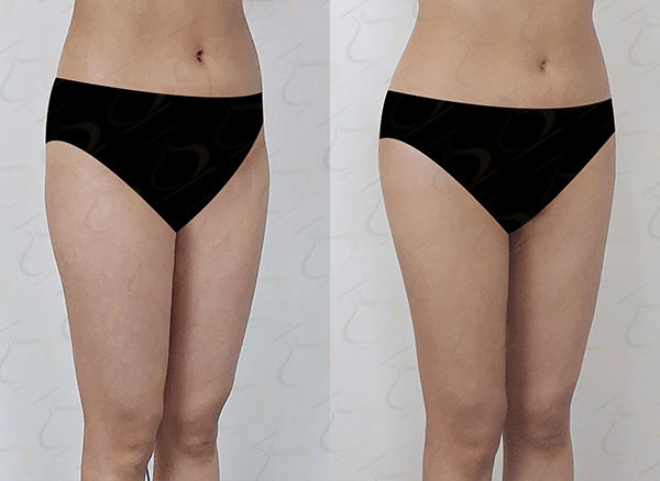 2dc1913b91c5f7e70ca3697767f2b6c1_1775438164_9181.jpg 2dc1913b91c5f7e70ca3697767f2b6c1_1775438164_9181.jpg