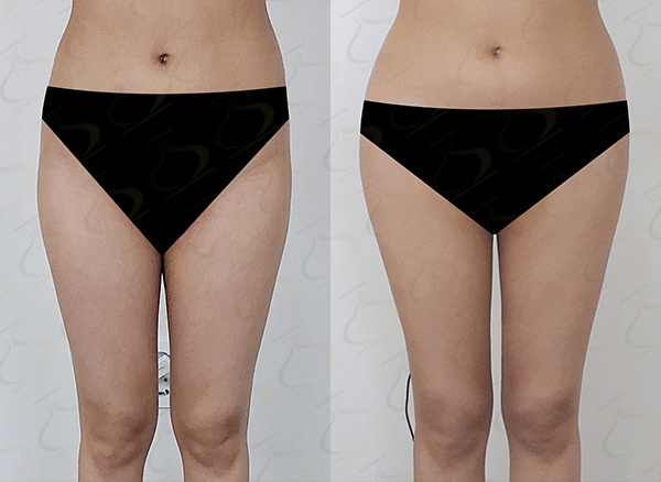 2dc1913b91c5f7e70ca3697767f2b6c1_1775438165_6804.jpg 2dc1913b91c5f7e70ca3697767f2b6c1_1775438165_6804.jpg