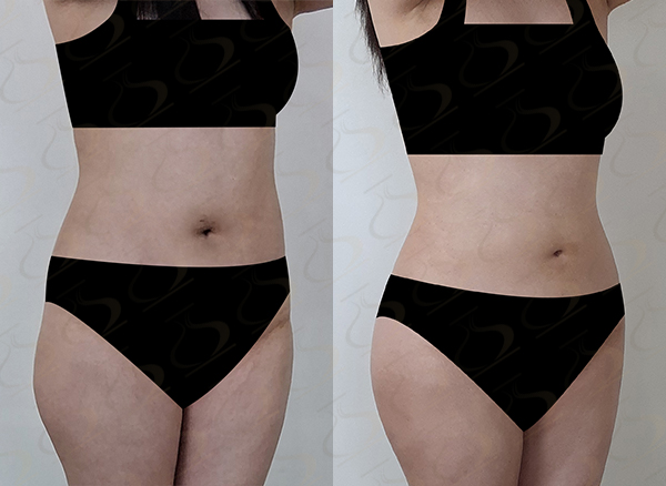 3dddf9ecf883e3027fbc2621fb6dff1b_1775178660_4949.jpg 3dddf9ecf883e3027fbc2621fb6dff1b_1775178660_4949.jpg