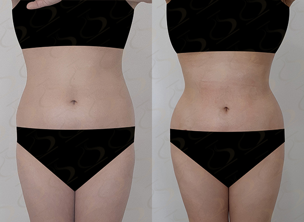 966342eac6befc59d7f3095b1cc117ef_1775786821_8607.jpg 966342eac6befc59d7f3095b1cc117ef_1775786821_8607.jpg