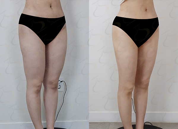 a203fbb27c9b0e37be47d1527fc142ac_1776041651_918.jpg a203fbb27c9b0e37be47d1527fc142ac_1776041651_918.jpg