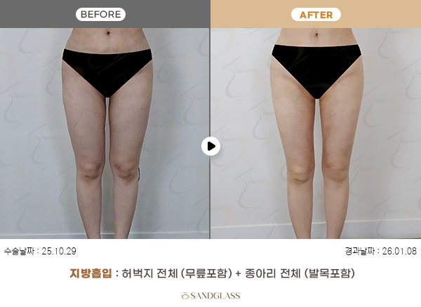 a203fbb27c9b0e37be47d1527fc142ac_1776041652_321.jpg a203fbb27c9b0e37be47d1527fc142ac_1776041652_321.jpg