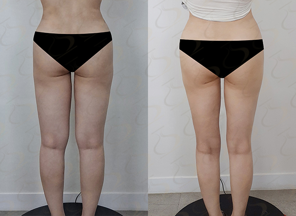 a203fbb27c9b0e37be47d1527fc142ac_1776041653_2016.jpg a203fbb27c9b0e37be47d1527fc142ac_1776041653_2016.jpg