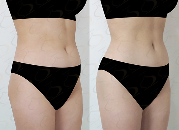 cee9998444c49ec42b312203c58e48c6_1775523825_3214.jpg cee9998444c49ec42b312203c58e48c6_1775523825_3214.jpg