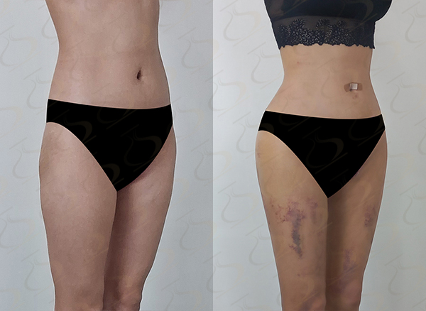 f6a63b56462583321a4a39f7d36935d6_1775006157_0308.jpg f6a63b56462583321a4a39f7d36935d6_1775006157_0308.jpg