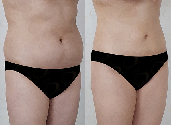 f6a63b56462583321a4a39f7d36935d6_1775006221_0627.jpg f6a63b56462583321a4a39f7d36935d6_1775006221_0627.jpg