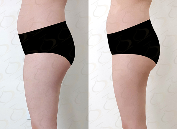909f763f07c8e2bd503b7a391915c7b4_1783043571_8349.jpg 909f763f07c8e2bd503b7a391915c7b4_1783043571_8349.jpg